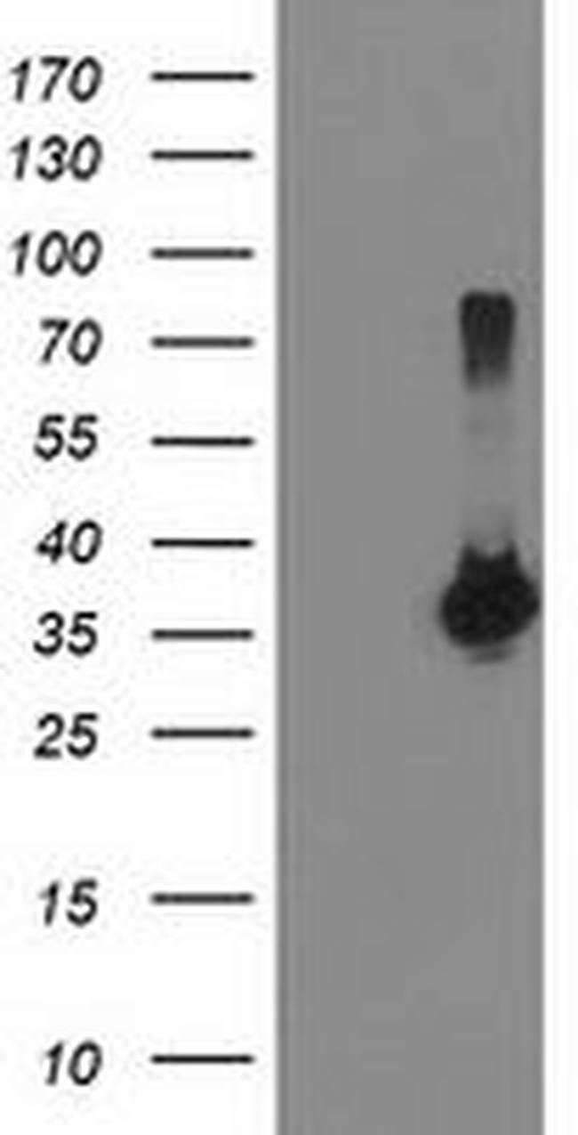 LDLRAP1 Antibody in Western Blot (WB)