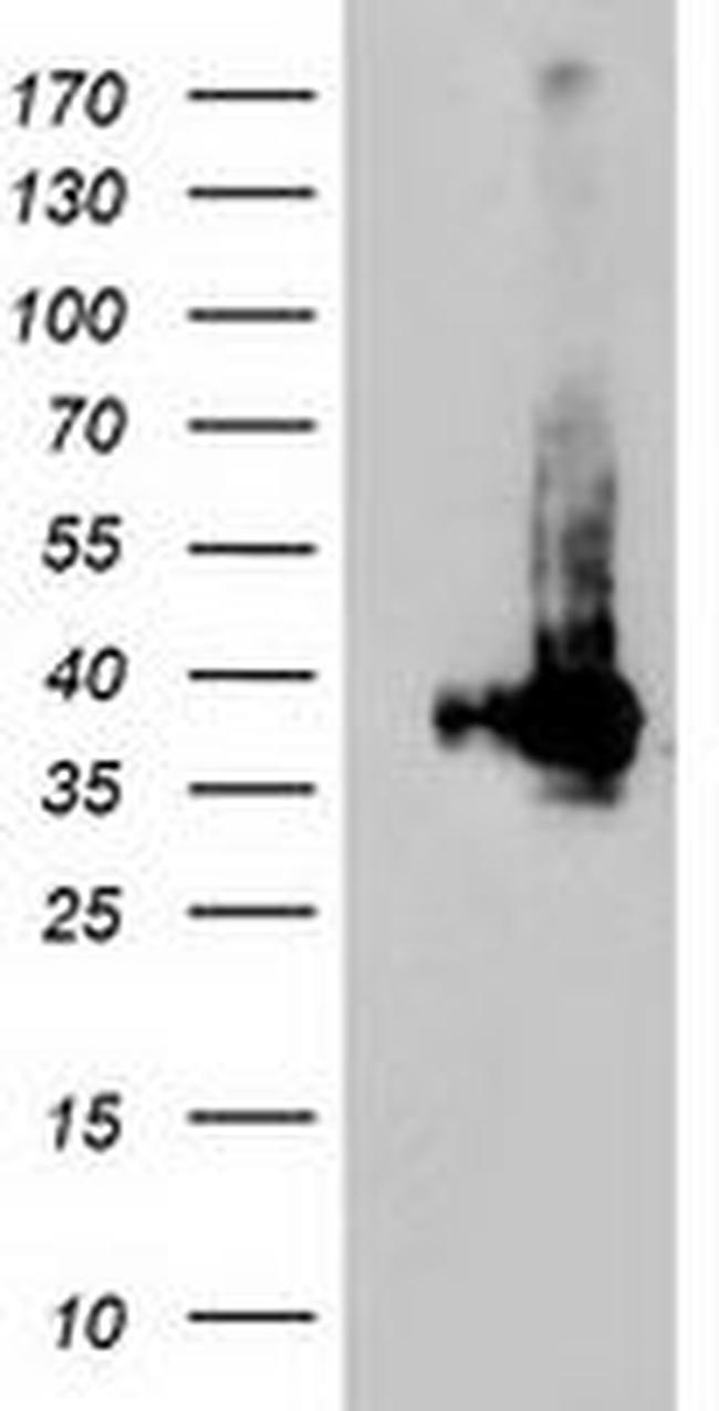 LDLRAP1 Antibody in Western Blot (WB)