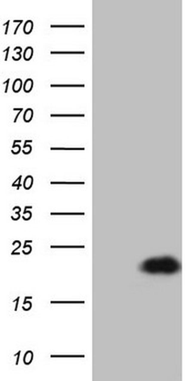 LELP1 Antibody in Western Blot (WB)