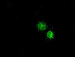 LEMD3 Antibody in Immunocytochemistry (ICC/IF)