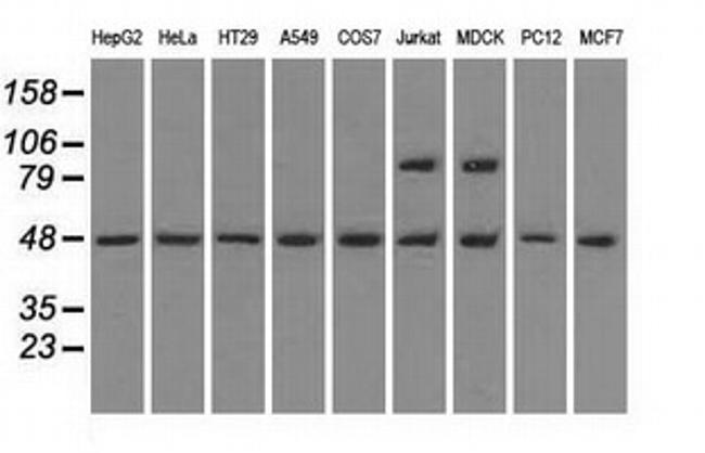 LEMD3 Antibody in Western Blot (WB)