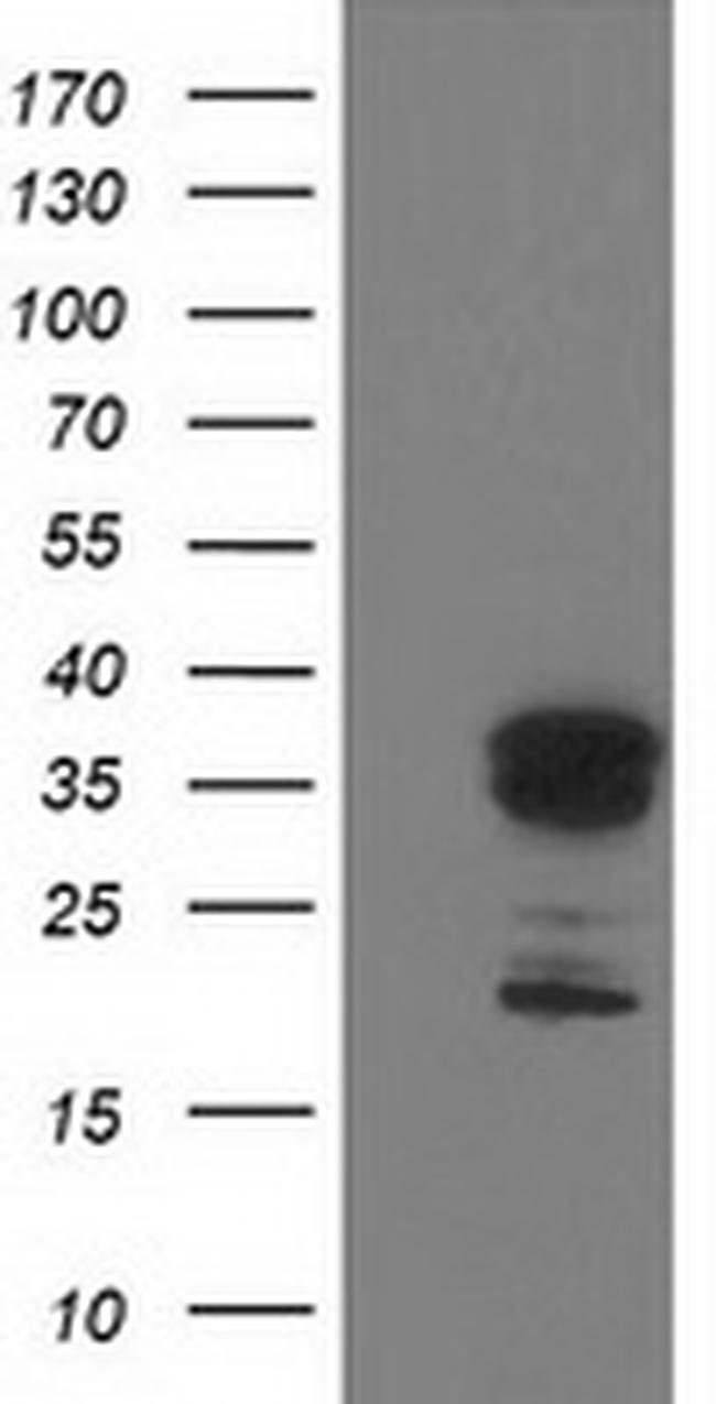 LENG1 Antibody in Western Blot (WB)