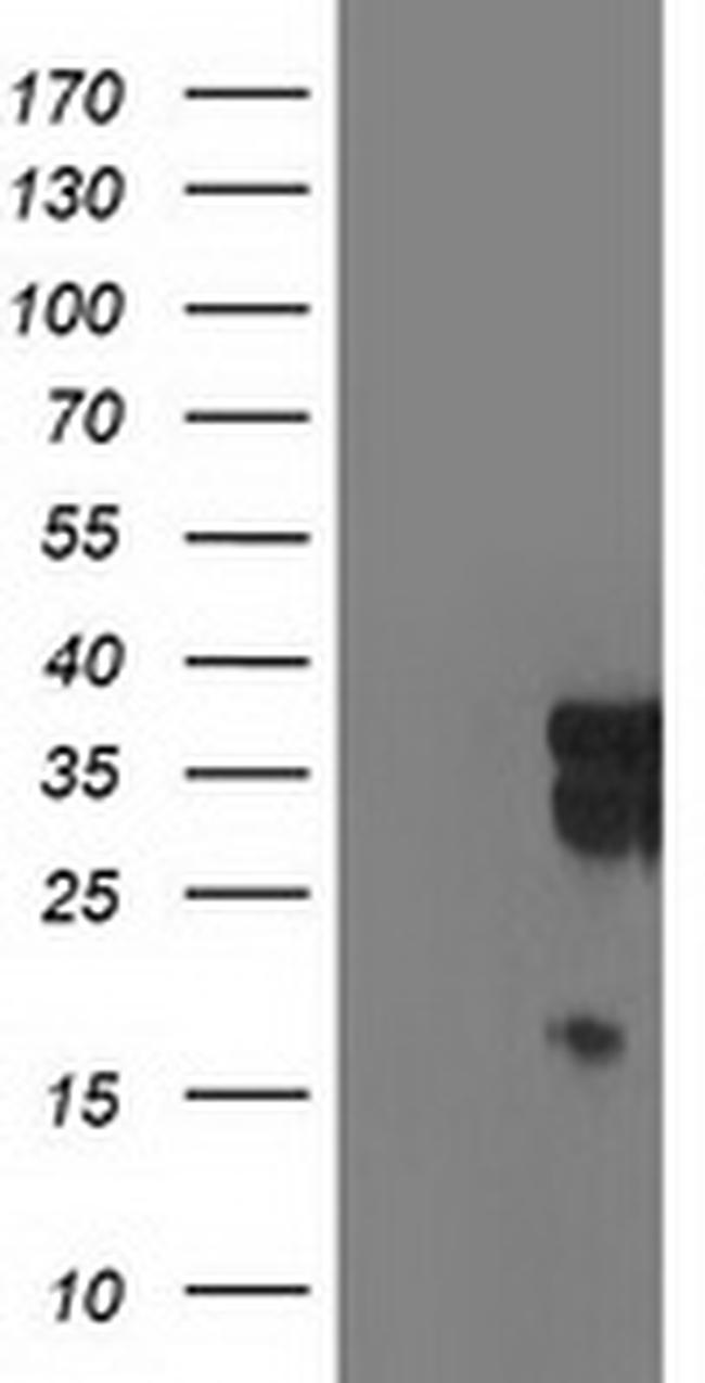 LENG1 Antibody in Western Blot (WB)