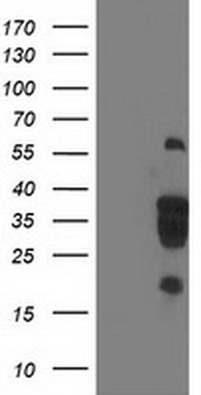 LENG1 Antibody in Western Blot (WB)