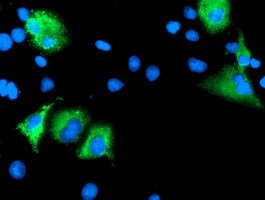 LEPRE1 Antibody in Immunocytochemistry (ICC/IF)