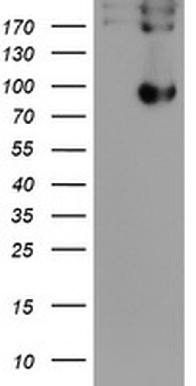 LEPRE1 Antibody in Western Blot (WB)