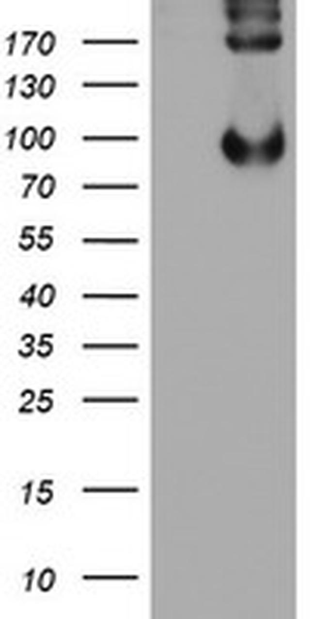 LEPRE1 Antibody in Western Blot (WB)