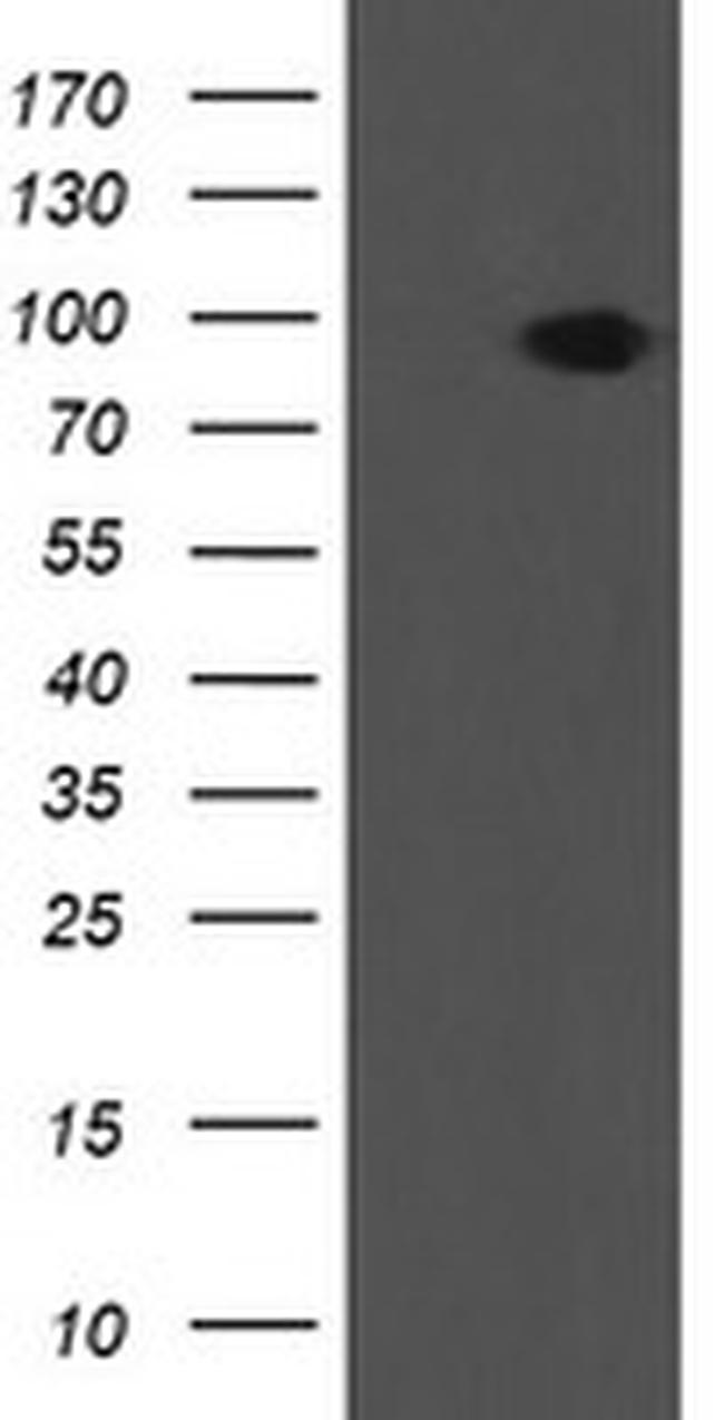 LEPRE1 Antibody in Western Blot (WB)