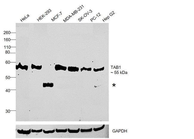 TAB1 Antibody in Western Blot (WB)