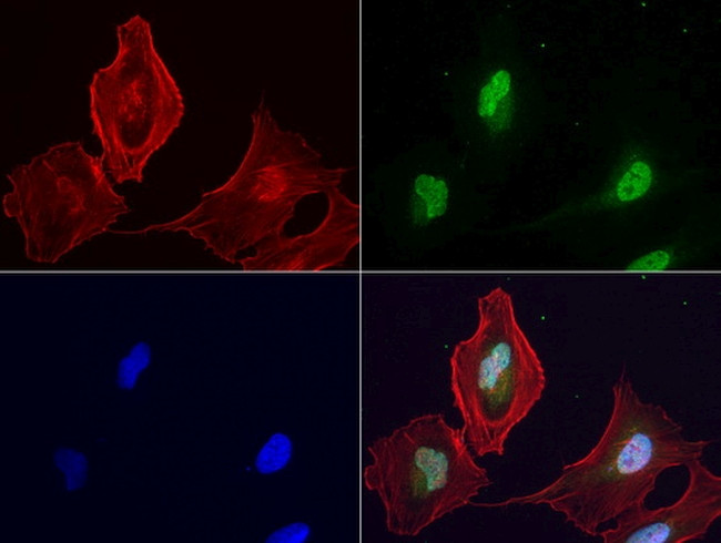 LGALS3 Antibody in Immunocytochemistry (ICC/IF)