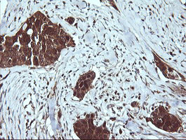 LGALS3 Antibody in Immunohistochemistry (Paraffin) (IHC (P))