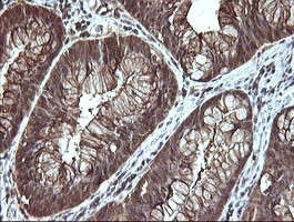 LGALS3 Antibody in Immunohistochemistry (Paraffin) (IHC (P))