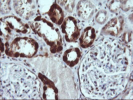 LGALS3 Antibody in Immunohistochemistry (Paraffin) (IHC (P))