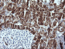 LGALS3 Antibody in Immunohistochemistry (Paraffin) (IHC (P))