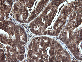 LGALS3 Antibody in Immunohistochemistry (Paraffin) (IHC (P))