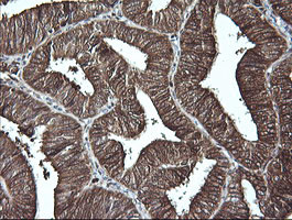 LGALS3 Antibody in Immunohistochemistry (Paraffin) (IHC (P))