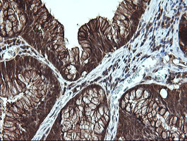 LGALS3 Antibody in Immunohistochemistry (Paraffin) (IHC (P))