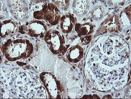 LGALS3 Antibody in Immunohistochemistry (Paraffin) (IHC (P))