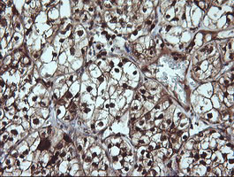 LGALS3 Antibody in Immunohistochemistry (Paraffin) (IHC (P))