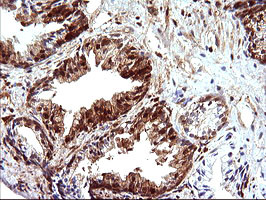 LGALS3 Antibody in Immunohistochemistry (Paraffin) (IHC (P))