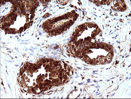 LGALS3 Antibody in Immunohistochemistry (Paraffin) (IHC (P))