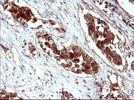 LGALS3 Antibody in Immunohistochemistry (Paraffin) (IHC (P))