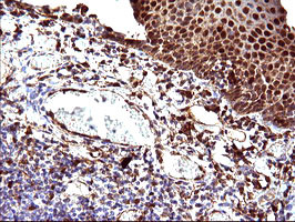 LGALS3 Antibody in Immunohistochemistry (Paraffin) (IHC (P))