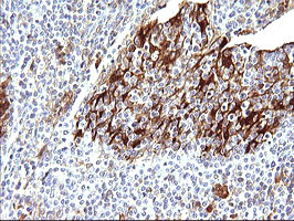 LGALS3 Antibody in Immunohistochemistry (Paraffin) (IHC (P))