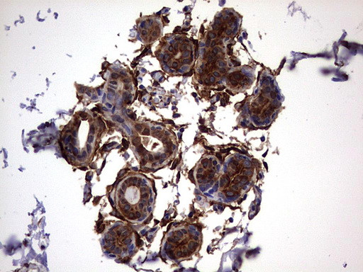 LGALS3 Antibody in Immunohistochemistry (Paraffin) (IHC (P))