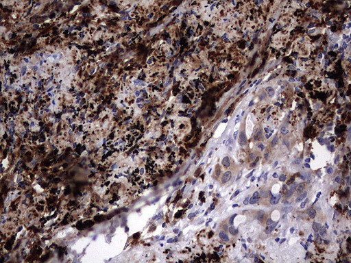 LGALS3 Antibody in Immunohistochemistry (Paraffin) (IHC (P))