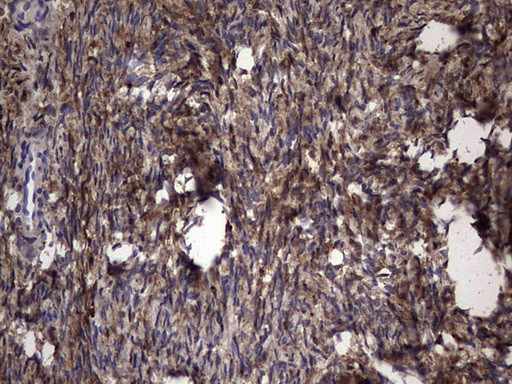 LGALS3 Antibody in Immunohistochemistry (Paraffin) (IHC (P))