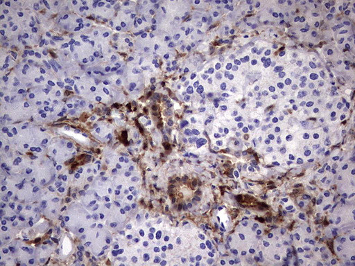 LGALS3 Antibody in Immunohistochemistry (Paraffin) (IHC (P))