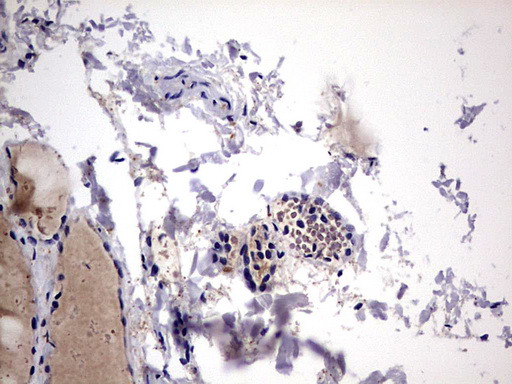 LGALS3 Antibody in Immunohistochemistry (Paraffin) (IHC (P))