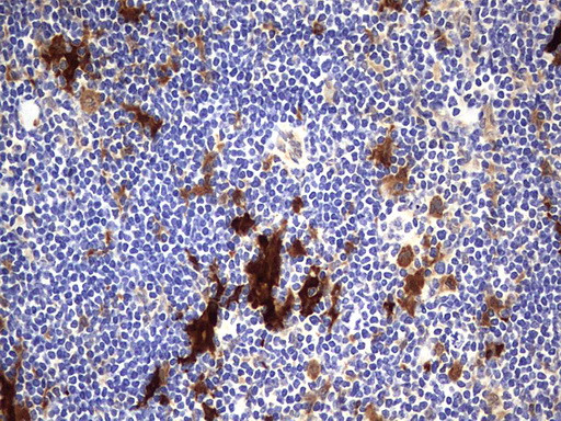 LGALS3 Antibody in Immunohistochemistry (Paraffin) (IHC (P))