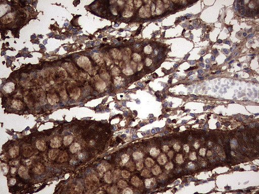 LGALS3 Antibody in Immunohistochemistry (Paraffin) (IHC (P))