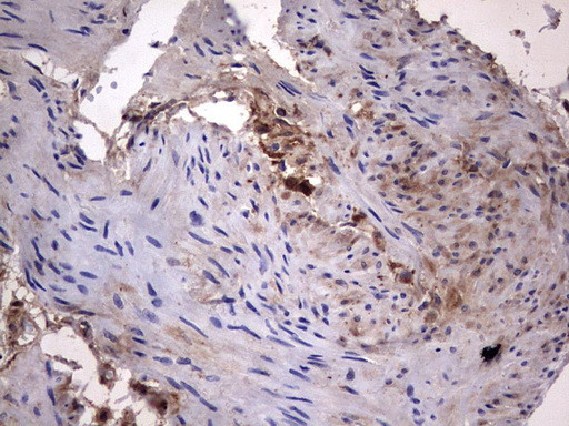 LGALS3 Antibody in Immunohistochemistry (Paraffin) (IHC (P))