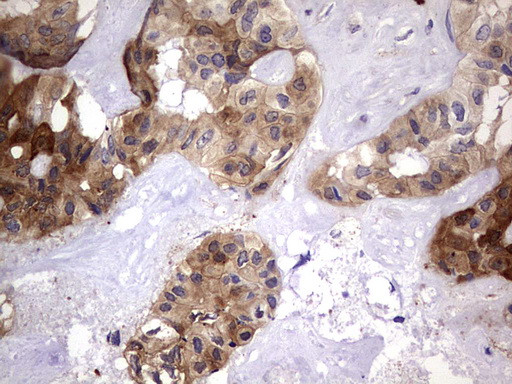 LGALS3 Antibody in Immunohistochemistry (Paraffin) (IHC (P))