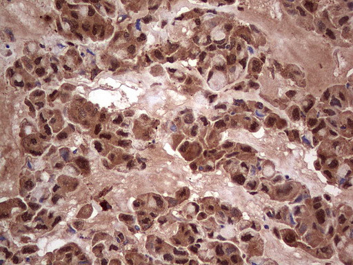 LGALS3 Antibody in Immunohistochemistry (Paraffin) (IHC (P))