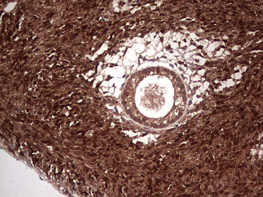 LGALS3 Antibody in Immunohistochemistry (Paraffin) (IHC (P))