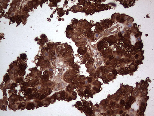 LGALS3 Antibody in Immunohistochemistry (Paraffin) (IHC (P))