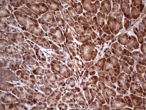 LGALS3 Antibody in Immunohistochemistry (Paraffin) (IHC (P))