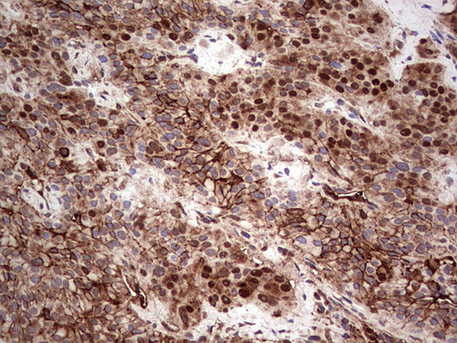 LGALS3 Antibody in Immunohistochemistry (Paraffin) (IHC (P))