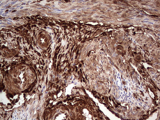 LGALS3 Antibody in Immunohistochemistry (Paraffin) (IHC (P))