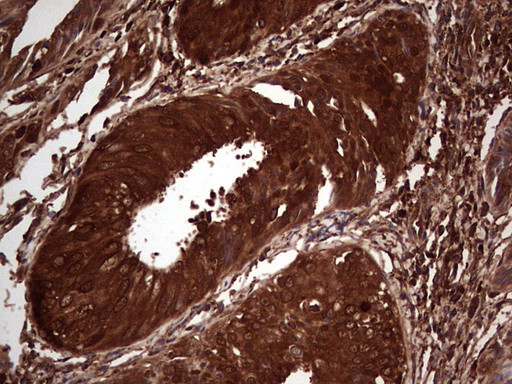 LGALS3 Antibody in Immunohistochemistry (Paraffin) (IHC (P))