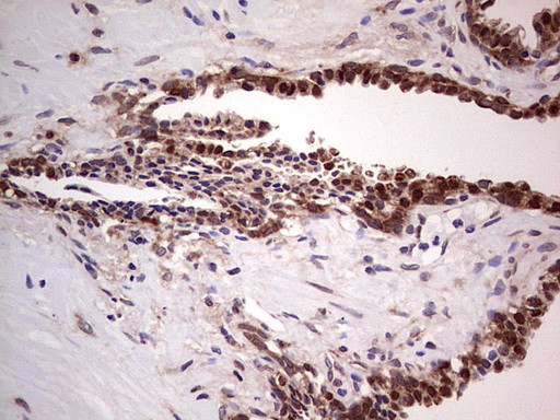 LGALS3 Antibody in Immunohistochemistry (Paraffin) (IHC (P))