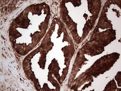 LGALS3 Antibody in Immunohistochemistry (Paraffin) (IHC (P))