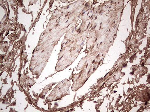 LGALS3 Antibody in Immunohistochemistry (Paraffin) (IHC (P))