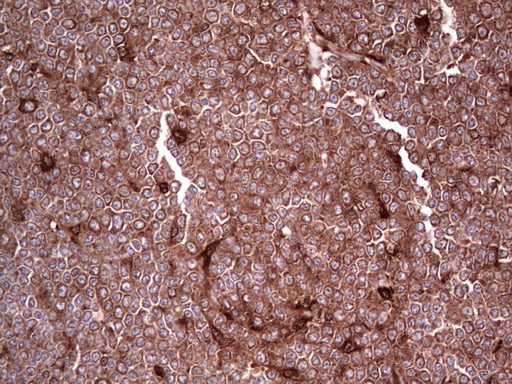 LGALS3 Antibody in Immunohistochemistry (Paraffin) (IHC (P))