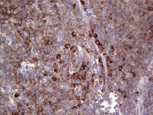 LGALS3 Antibody in Immunohistochemistry (Paraffin) (IHC (P))