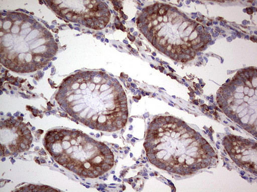 LGALS3 Antibody in Immunohistochemistry (Paraffin) (IHC (P))